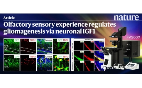 Make it Evident丨Nature新作！首次揭示膠質瘤的嗅覺調控機制